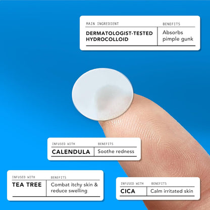 Avarelle Acne Cover Patches | Hydrocolloid Pimple Patches with Tea Tree, Cica & Calendula – Vegan, Cruelty-Free Korean Skincare Zit Patches
