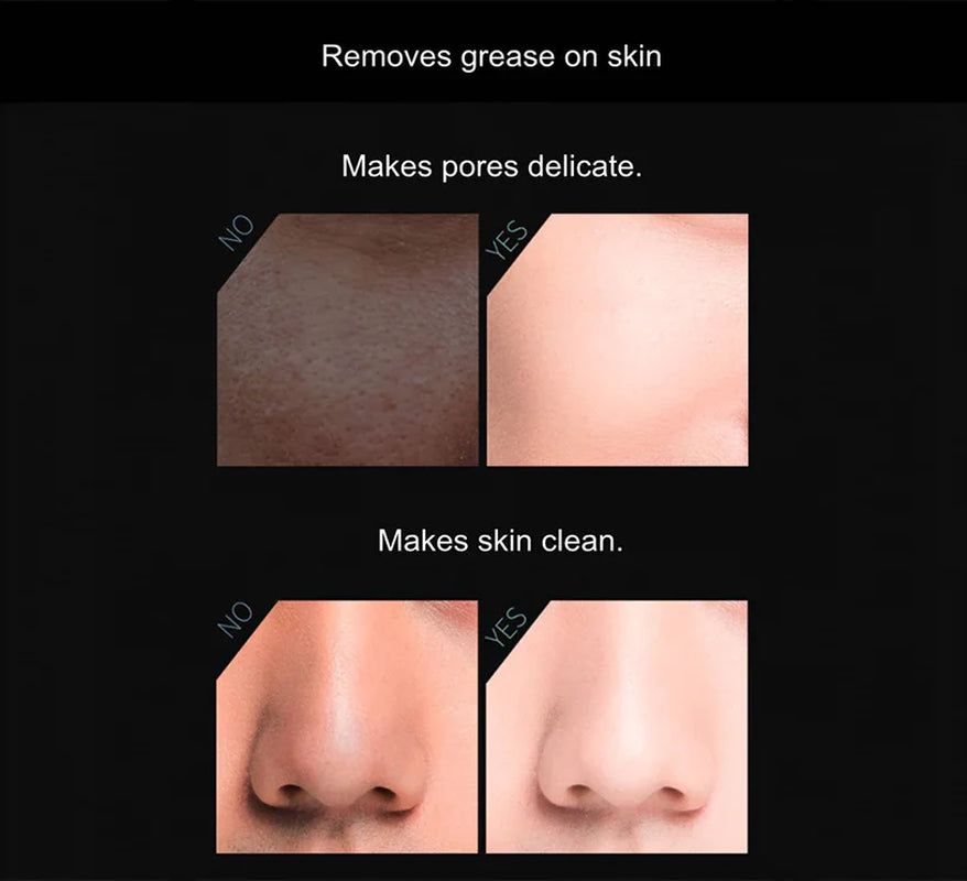 Volcanic Stone Oil-Absorbing Face Roller | Natural Mattifying & Pore-Clearing Tool – Reusable K-Beauty Shine Control