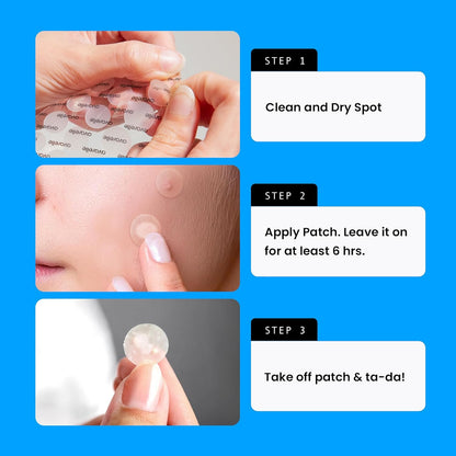 Avarelle Acne Cover Patches | Hydrocolloid Pimple Patches with Tea Tree, Cica & Calendula – Vegan, Cruelty-Free Korean Skincare Zit Patches